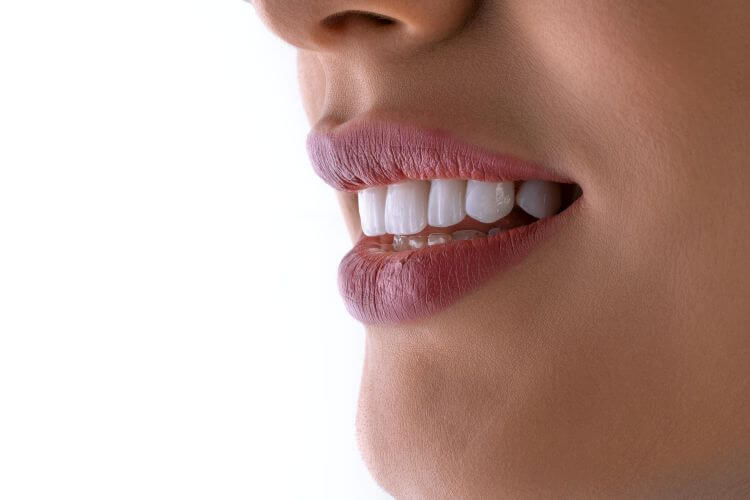 regular dental checkups