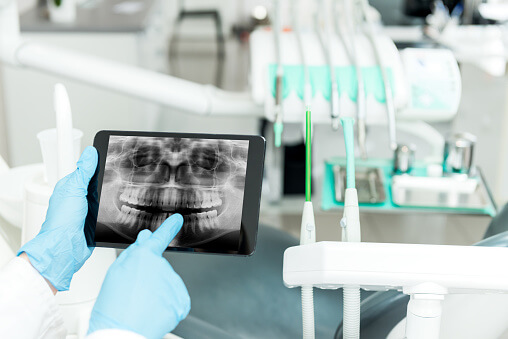 dentist pointing at an xray